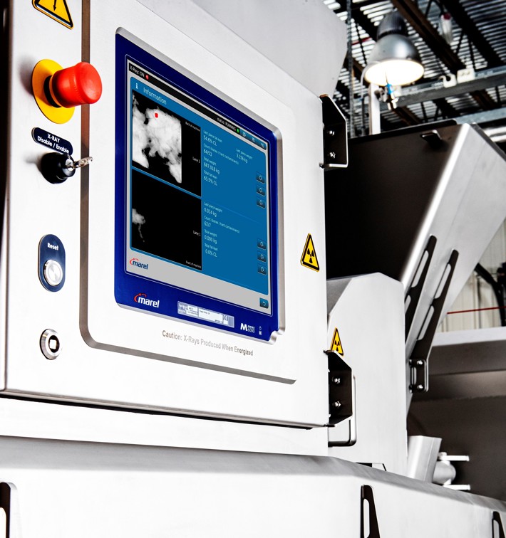 SensorX Magna X-ray bone detection displayed on screen